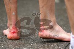 Triathlon Ingolstadt 2012 - Verletzungen an der Ferse Blut
